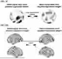 Fig. 04 - TREATMENT OF DEPRESSION USING MACHINE LEARNING