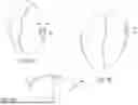 Fig. 15 - OPERATION EQUIPMENT FOR KNEE SURGERY, OPERATING ROOM PROVIDED WITH SUCH EQUIPMENT, ASSEMBLY KIT, AND CORRESPONDING METHODS FOR ASSEMBLY, OPERATION AND USE