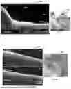 Fig. 06 - METHODS, SYSTEMS AND APPARATUSES FOR TRANSSEPTAL PROCEDURES