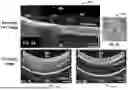Fig. 07 - METHODS, SYSTEMS AND APPARATUSES FOR TRANSSEPTAL PROCEDURES