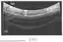 Fig. 08 - METHODS, SYSTEMS AND APPARATUSES FOR TRANSSEPTAL PROCEDURES