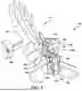 Fig. 06 - ANTERIOR ANKLE APPROACH SYSTEM AND METHOD