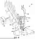 Fig. 09 - ANTERIOR ANKLE APPROACH SYSTEM AND METHOD