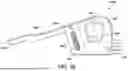 Fig. 30 - ANTERIOR ANKLE APPROACH SYSTEM AND METHOD