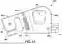 Fig. 33 - ANTERIOR ANKLE APPROACH SYSTEM AND METHOD