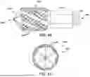 Fig. 41 - ANTERIOR ANKLE APPROACH SYSTEM AND METHOD