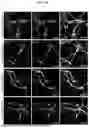 Fig. 23 - CELL TYPE SELECTIVE DELIVERY OF EXOSOME CARGO USING NOTCH LIGAND-RECEPTOR SYSTEM