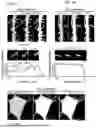 Fig. 26 - CELL TYPE SELECTIVE DELIVERY OF EXOSOME CARGO USING NOTCH LIGAND-RECEPTOR SYSTEM