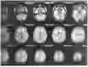 Fig. 01 - CONCOMITANT ADMINISTRATION OF OILS FOR MANAGING NEURODEGENERATIVE DISEASES AND DEVELOPMENTAL DISORDERS