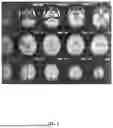 Fig. 02 - CONCOMITANT ADMINISTRATION OF OILS FOR MANAGING NEURODEGENERATIVE DISEASES AND DEVELOPMENTAL DISORDERS