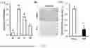 Fig. 02 - USE OF BIOACTIVE POLYPEPTIDE SYNTHESIZED ON BASIS OF KDM2B SEQUENCE IN NEURAL DIFFERENTIATION AND REGENERATION AND REPAIR OF MESENCHYMAL STEM CELLS