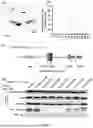Fig. 07 - USE OF BIOACTIVE POLYPEPTIDE SYNTHESIZED ON BASIS OF KDM2B SEQUENCE IN NEURAL DIFFERENTIATION AND REGENERATION AND REPAIR OF MESENCHYMAL STEM CELLS