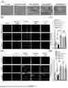 Fig. 08 - USE OF BIOACTIVE POLYPEPTIDE SYNTHESIZED ON BASIS OF KDM2B SEQUENCE IN NEURAL DIFFERENTIATION AND REGENERATION AND REPAIR OF MESENCHYMAL STEM CELLS