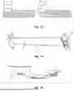 Fig. 06 - METHOD FOR MANUFACTURING A TURBOMACHINE BLADE
