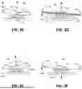 Fig. 14 - MILLIMETER WAVE DETECTOR ARRANGEMENT