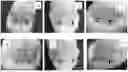 Fig. 01 - A POLYHERBAL LOCAL ANAESTHETIC FORMULATION AND A METHOD OF PREPARATION