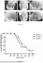 Fig. 02 - A POLYHERBAL LOCAL ANAESTHETIC FORMULATION AND A METHOD OF PREPARATION