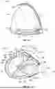 Fig. 11 - GOLF CLUB HEADS