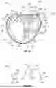 Fig. 14 - GOLF CLUB HEADS