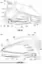 Fig. 15 - GOLF CLUB HEADS