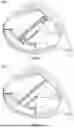 Fig. 47 - GOLF CLUB HEADS