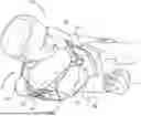Fig. 01 - Shoulder Support for Lateral Decubitus Positioning