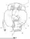 Fig. 02 - Shoulder Support for Lateral Decubitus Positioning