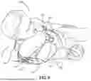 Fig. 07 - Shoulder Support for Lateral Decubitus Positioning