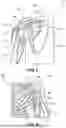 Fig. 09 - Shoulder Support for Lateral Decubitus Positioning
