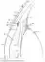 Fig. 01 - INTRAOCULAR IMPLANTS AND RELATED KITS AND METHODS