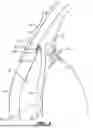 Fig. 02 - INTRAOCULAR IMPLANTS AND RELATED KITS AND METHODS