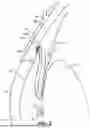 Fig. 03 - INTRAOCULAR IMPLANTS AND RELATED KITS AND METHODS