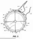 Fig. 04 - INTRAOCULAR IMPLANTS AND RELATED KITS AND METHODS