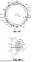 Fig. 05 - INTRAOCULAR IMPLANTS AND RELATED KITS AND METHODS