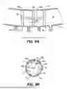 Fig. 10 - INTRAOCULAR IMPLANTS AND RELATED KITS AND METHODS