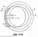 Fig. 12 - INTRAOCULAR IMPLANTS AND RELATED KITS AND METHODS