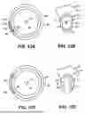 Fig. 14 - INTRAOCULAR IMPLANTS AND RELATED KITS AND METHODS