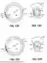 Fig. 15 - INTRAOCULAR IMPLANTS AND RELATED KITS AND METHODS