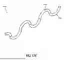 Fig. 30 - INTRAOCULAR IMPLANTS AND RELATED KITS AND METHODS