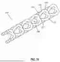 Fig. 38 - INTRAOCULAR IMPLANTS AND RELATED KITS AND METHODS
