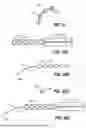 Fig. 44 - INTRAOCULAR IMPLANTS AND RELATED KITS AND METHODS