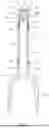 Fig. 07 - BICYCLE FRONT-END MECHANISM FOR QUICK ASSEMBLY
