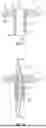 Fig. 03 - SUTURE LOCKING DEVICES FOR PERFORMING TENSIONABLE KNOTLESS SURGICAL PROCEDURES