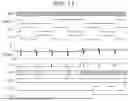 Fig. 10 - Failure Diagnosis Circuit, Vibrator Device, And Physical Quantity Sensor