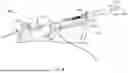 Fig. 22 - DEVICES, SYSTEMS, AND METHODS FOR TREATING THE LEFT ATRIAL APPENDAGE