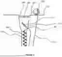 Fig. 04 - APPARATUS FOR THE MANUFACTURE OF THREE-DIMENSIONAL OBJECTS