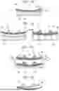 Fig. 02 - FORMING METHOD AND FORMING DEVICE