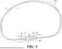 Fig. 02 - Wearable Noise-Reducing Device