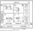 Fig. 28 - ALGORITHM-BASED OPTIMIZATION FOR KNEE ARTHROPLASTY PROCEDURES