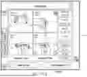 Fig. 29 - ALGORITHM-BASED OPTIMIZATION FOR KNEE ARTHROPLASTY PROCEDURES